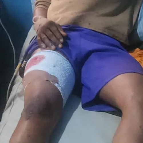 Tension in Osun as 12-year-old boy shot during APC campaign in Ilesa