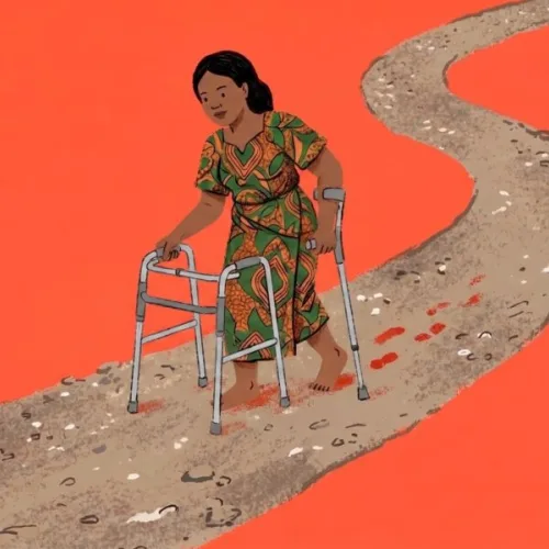Susan Uko on How She Recovered After Two Total Hip Replacement Surgeries