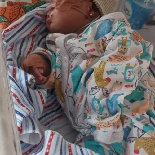 Family seeks N17m for three-month-old’s heart surgery