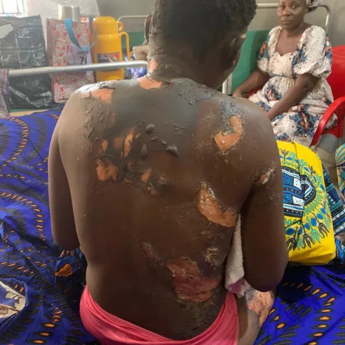 Police to prosecute Kogi pastor for setting wife ablaze