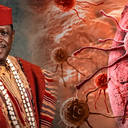 Ogogo: What to know about cancer stages, symptoms, survival chances