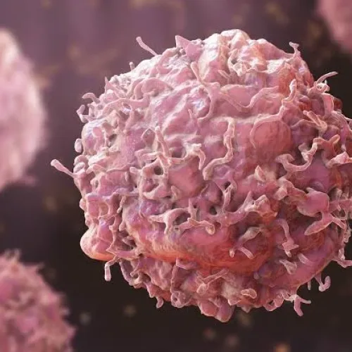 Cancer exists, keeping quiet is dangerous, Oncologist warns Nigerians